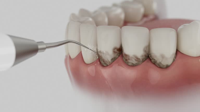 Reliable Dental Implants contractor in Broken Bow, NE by Smile Center Dentistry